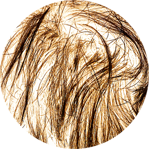 Hair Loss Causes Left