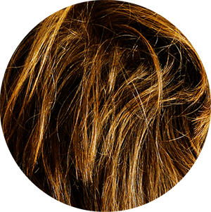 Hair Loss Causes Right